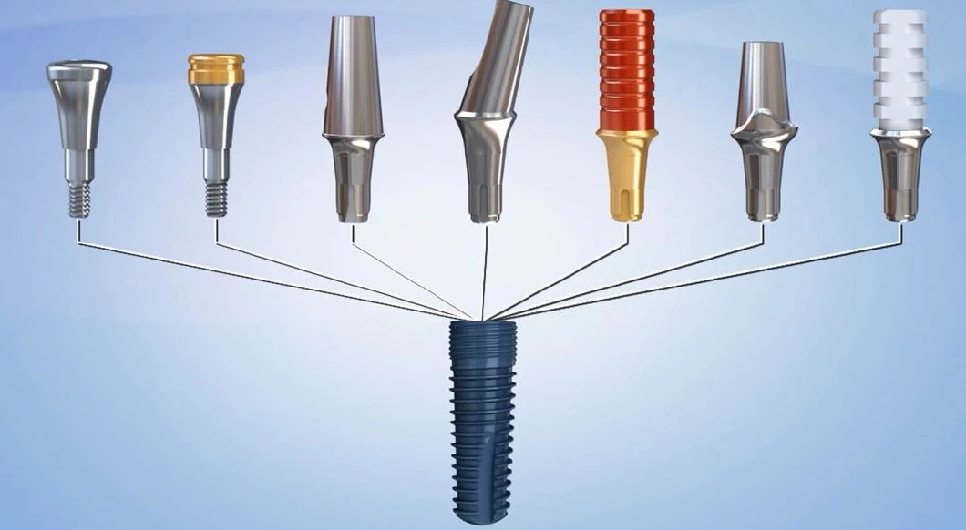 High-Quality Titanium PT Fixture (Pine Tree Fixture) SLA, Tapered Korea Dental Implant Materials