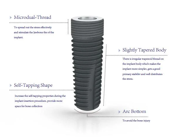 High-Quality Titanium PT Fixture (Pine Tree Fixture) SLA, Tapered Korea Dental Implant Materials